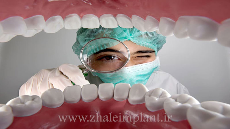 ارزیابی سلامت دهان و دندان از شرایط لازم جهت ایمپلنت دندان