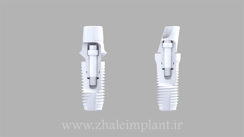 ایمپلنت های دو پیچه (Two-piece implants)